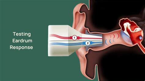 Tympanometry: Procedure Details & Results .